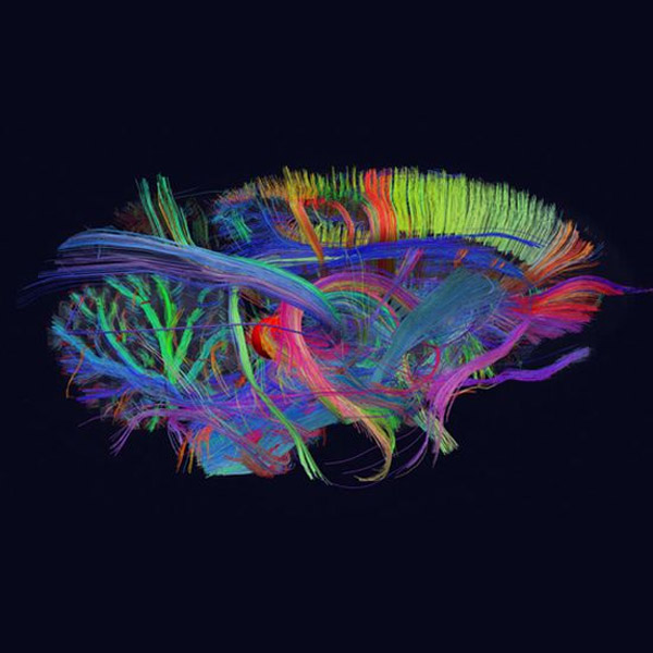 BigBrain,мозг,big data,анатомия, Весь человеческий мозг на 3D-карте